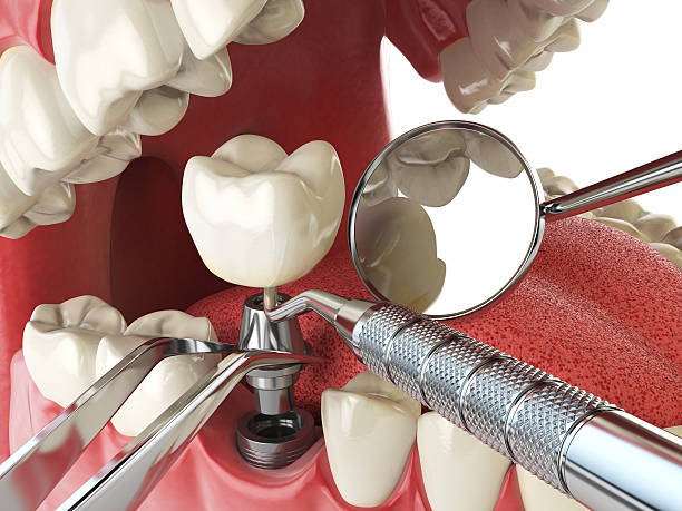 Best Knocked-Out Tooth Emergency  in Warsaw, IL
