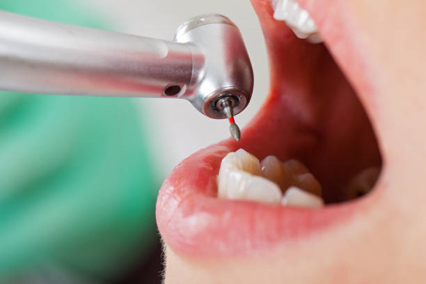 Best Dentist for Dental Trauma  in Warsaw, IL